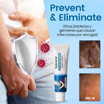 Crema Natravor™ para el alivio de las verrugas genitales causadas por el VPH ✅ ¡70 % de descuento! ¡Termina en 10 minutos!