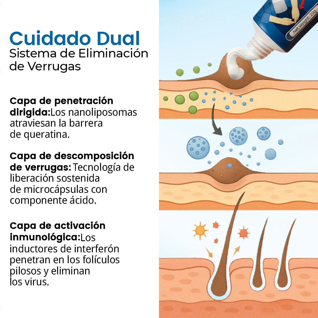 Crema Natravor™ para el alivio de las verrugas genitales causadas por el VPH ✅ ¡70 % de descuento! ¡Termina en 10 minutos!