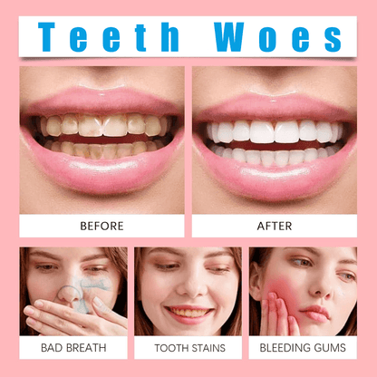 Intensive Teeth Whitening Toothpaste